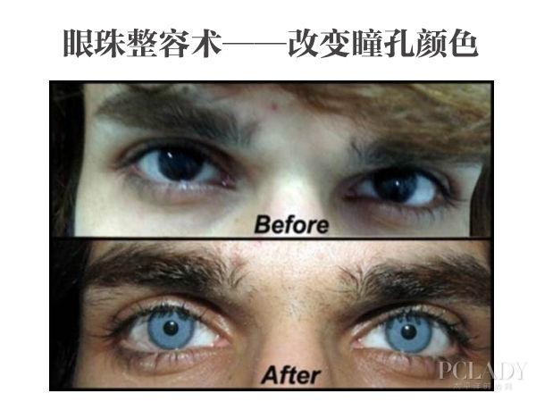 TV端日均流量破亿 欧派家居联手乐视第一流量终端平台 超级爱+计划在京揭幕:三亿体育官网